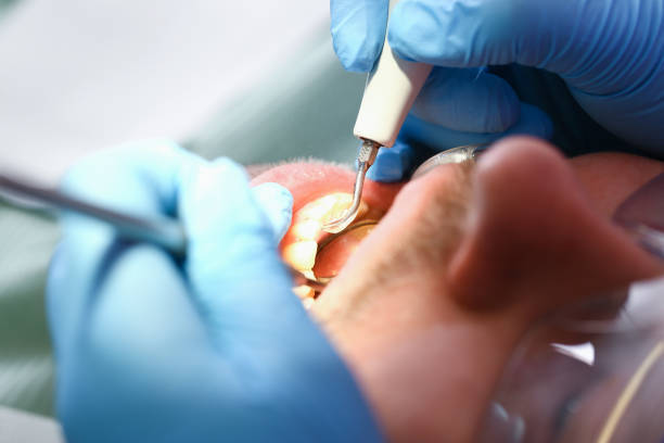 Best Emergency Treatment for Dental Infections or Abscesses in Seneca, KS