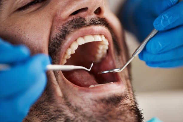 Best Emergency Tooth Extraction in Seneca, KS